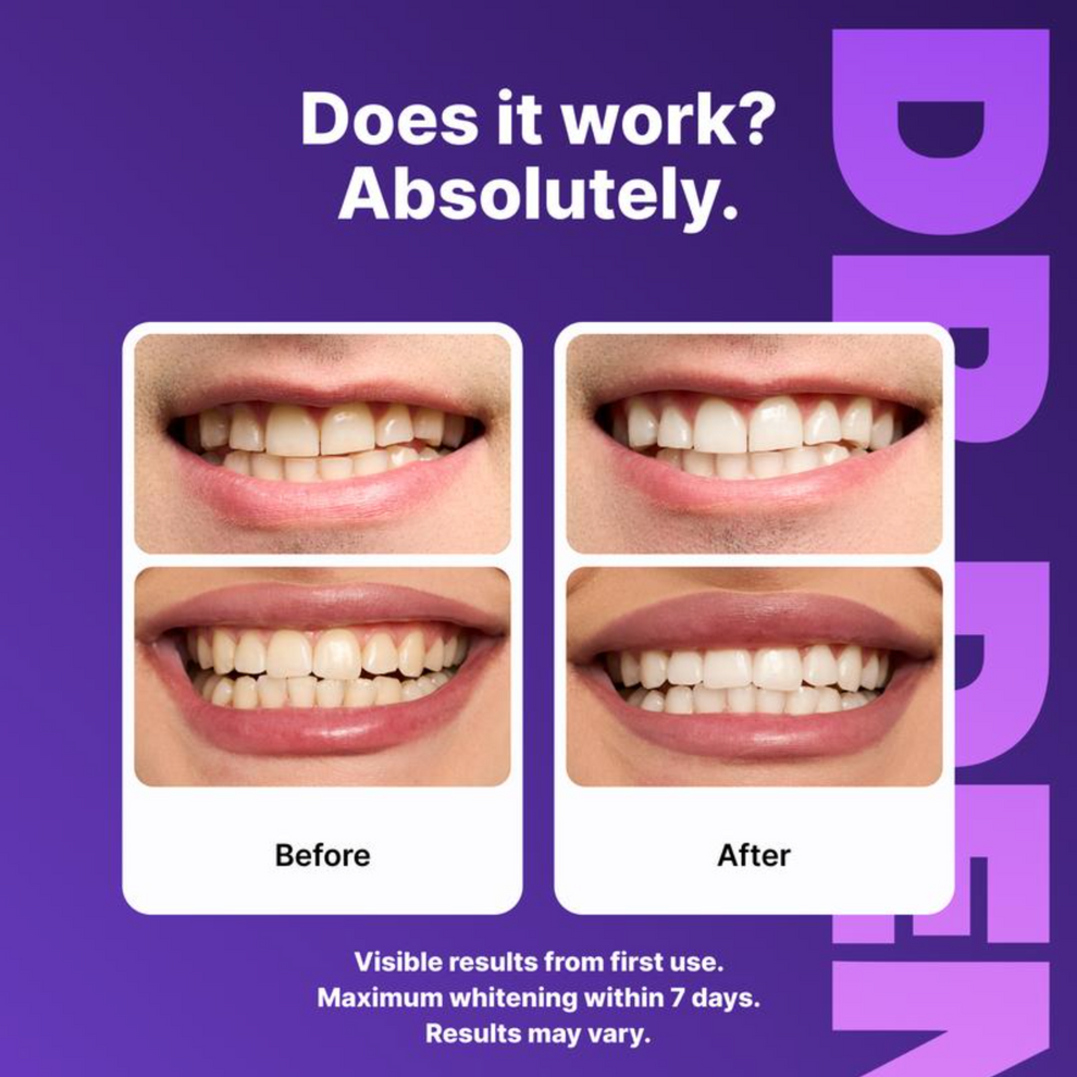 Whitiq™ Color-Correct Whitening Strips
