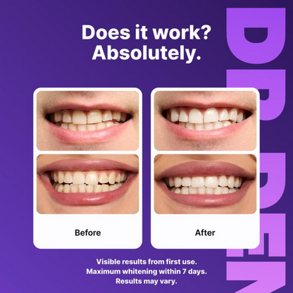 Whitiq™ Color-Correct Whitening Strips